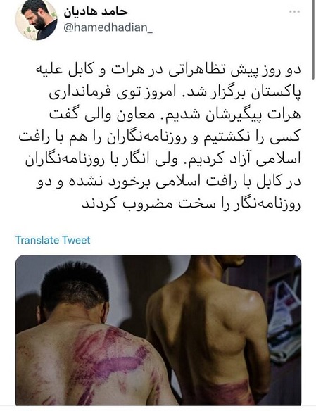 رفتار وحشیانه طالبان با خبرنگاران + عکس