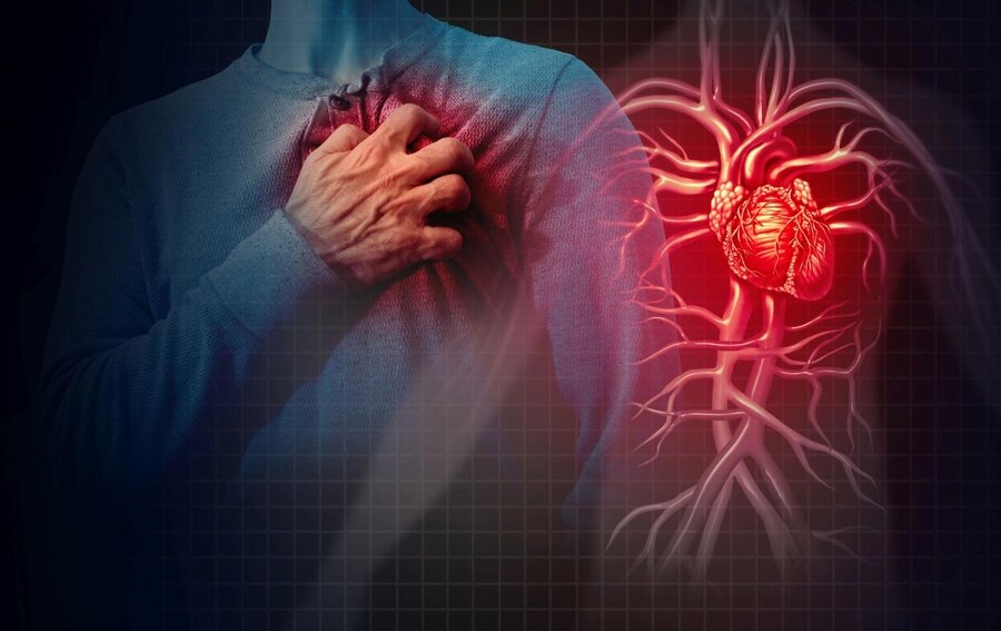 ۵ اقدام سریع در هنگام سکته قلبی / افزایش موارد ایست قلبی