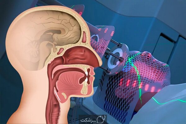 علائم اصلی سرطان سر و گردن که باید از آنها آگاه باشید