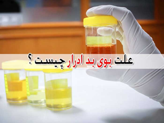 ۴ غذا و نوشیدنی که ممکن است باعث بوی بد ادرار شما شود