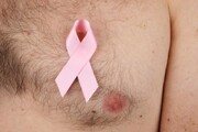علائم و علل اصلی سرطان سینه در مردان