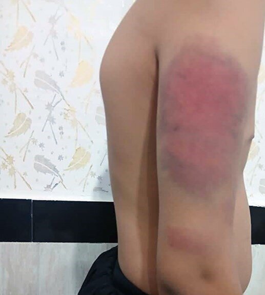 ضرب و شتم دانشآموزان با کابل توسط معلم سنندجی/ آموزش و پرورش وعده برخورد قاطع داد + عکس