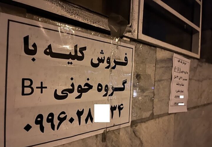 جزئیات تکان‌دهنده از فروش کلیه ۷۰میلیاردی در تهران!